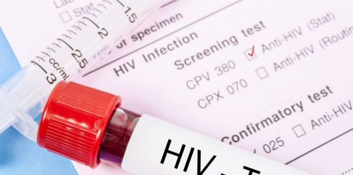 A photo of an HIV test specimen